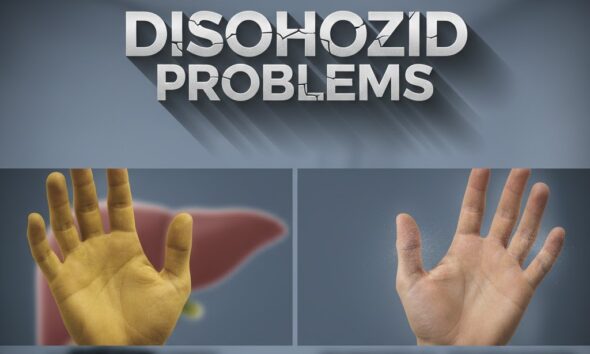 disohozid problems